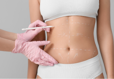 Can Ozempic Replace Liposuction? A Comprehensive Guide to Body Contouring in the UK