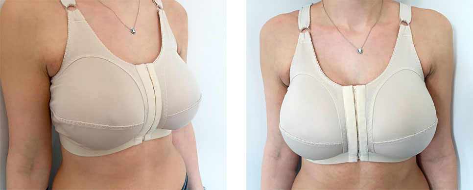 Why Are Bras so Uncomfortable?
